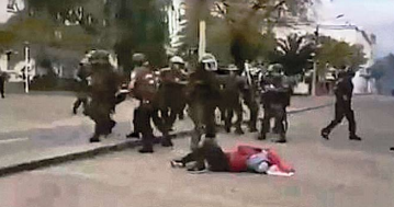 Mujer herida en manifestación podría perder su ojo